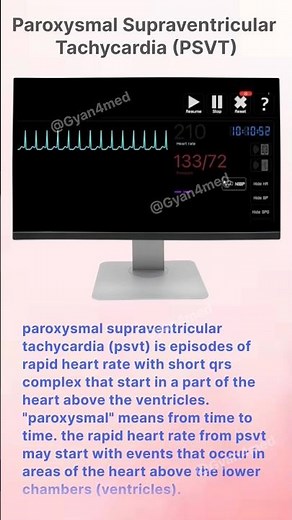 Paroxysmal Supraventricular Tachycardia (PSVT)