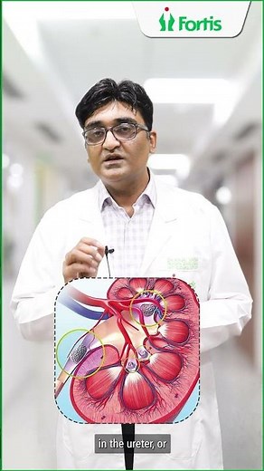 Laser Treatment for Kidney Stones: Effective Solutions from Dr. Rajat Arora
