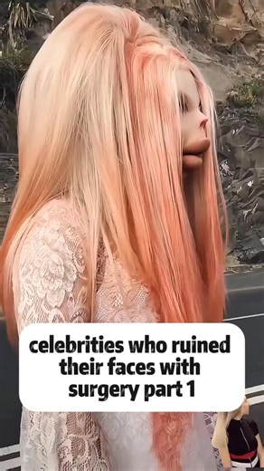Stars Delight on Instagram: "Celebrities who ruined their faces with surgeries #fyp #fyp #foryouシ #foryoupageシ #viralreelsfacebook #celebrity #celebrities #celebritynews #actors #hollywood #actorslife #trendingreel #viralreelsfb #explorepage #discovery #usa"