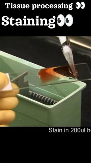 Grossing & Tissue processing 👀 @Mgugcollege2709 #dmlt #shortsfeed #histopathology #histopath#lab