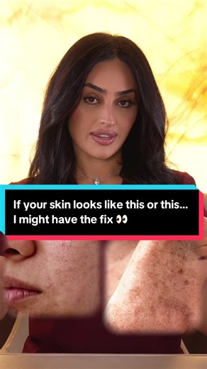 Understanding Unpredictable Skin Texture and Breakouts