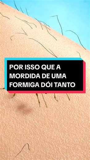 A Dor da Mordida de Formiga e Seus Efeitos