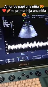 1.3K views | Amor de papi  | Fabio Gonsales | Facebook