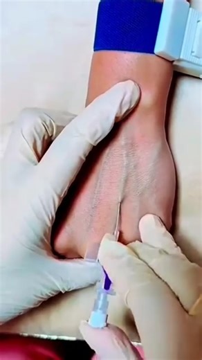 MHs_medical on Instagram: "Iv cunnulation ✅😱😱 #practice #knowledge #doctor #medicalstudent #hospital #hospitaltraining #viralreels #viralshort"