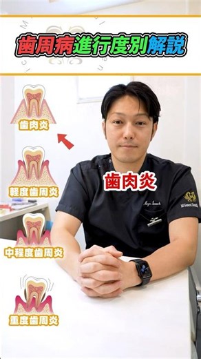 手遅れになる前に！歯周病の4つの段階 #歯周病 #定期検診 #予防歯科 #歯医者 #MI総合歯科クリニック