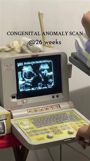 Congenital Anomaly Scan at 26 Weeks: Celebrating Health