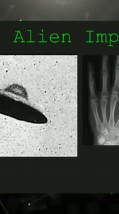 1.8K views · 49 reactions | Alien Implants at Various Levels Visit us www.fulldisclosure.network #FullDisclosure​ #UFO​ #Aliens​ #TruthSeekersUnite #PodcastDrop #BrianTseng #SolarBee #AwakenHumanity #FullDisclosureNow #TimeTravel #ConsciousConversations | Brian Tseng | Facebook