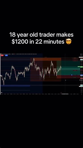 dy1an.fx || Trading & Lifestyle on Instagram: "Yesterday’s gold trade! 3:1RR Trade 1% better each day. #daytrading #discord #nasdaq #daytrader #fullport"