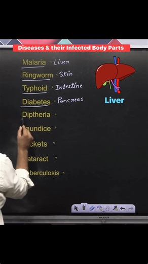 494K views · 6.1K reactions |  Diseases & their Infected Body Parts 贈樂 !! #biology #diseases #infectedparts #humanbody #facts #knowledge #sciencefacts #study #education #exams #NEET #upsc #knowledgeispower #gkquestions #facebookreelsviral #fbreelsvideo #facebookreelsvideo #fbreelsviral #facebookreels #reelsviral #reelsfb | Krishna Thakur | Facebook