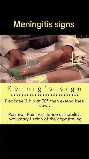 Brudzinski’s & Kernig’s Signs: Clues for Meningitis? #meningitis