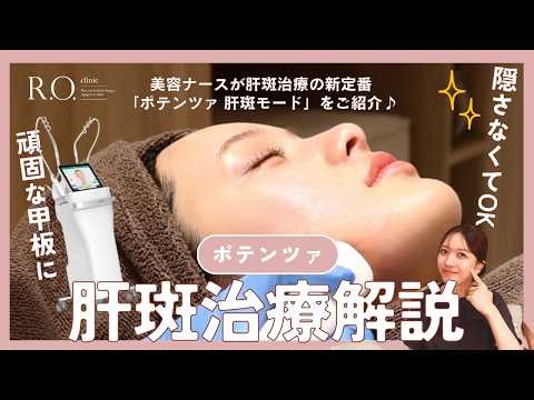 [How Melasma Works] What types of melasma treatments are there? We'll introduce recommended treat...