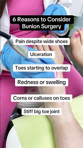 6 Reasons to Consider Bunion Surgery