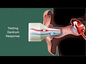 WHAT DOES A TYMPANOMETRY TEST DO?