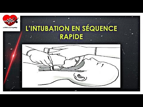 l'intubation en séquence rapide