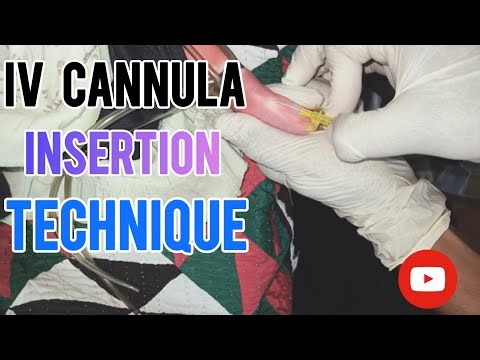 IV Cannulation | IV cannula insertion | intravenous therapy in FOOT | intravenous cannulation