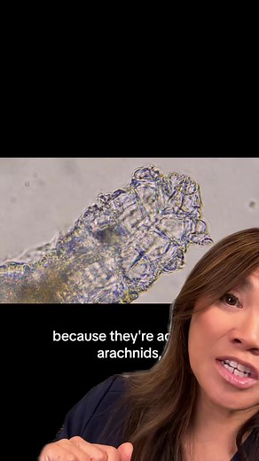 Dermatology Discovery: Unveiling Demodex Mites on Your Skin