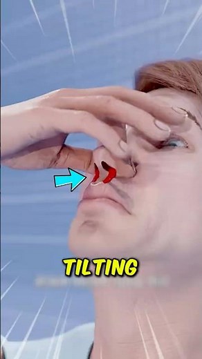 The Right Way to Stop a Nosebleed (Most People Do It Wrong)