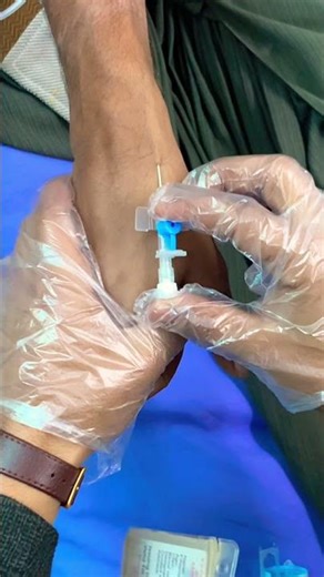 IV cannulation #canula #technique #ivcannula #medical#information#injection
