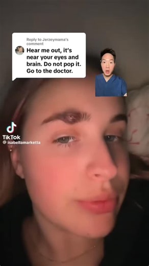 Dr. David Kim | Do not pop that pimple! A little anatomy lesson here! If you pop a pimple in the eyebrows and it gets infected, the infection can travel... | Instagram