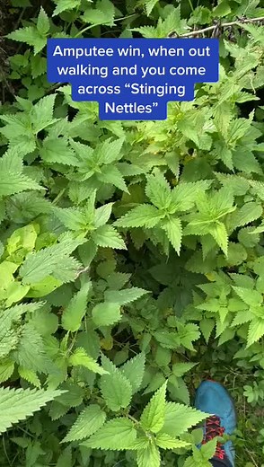 #walking #hike #feet #amputee #sting #leg #oneleg #funny #comedy