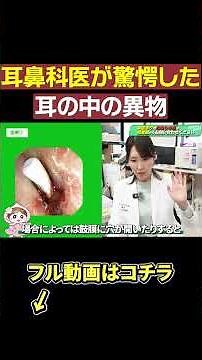 [Too scary] Ear pick broken inside the ear [Experience of an ENT doctor]