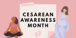 Cesarean Awareness Month: The risks and benefits of C-sections