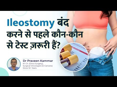 Ileostomy Closure के लिए जरूरी Tests! | Step by Step Tests & Safety Tips! |Dr Praveen Kammar, Mumbai