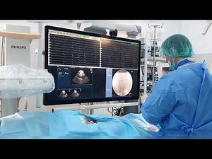 Premieră în Spitalul Militar Central - prima Ablație de Fibrilație atrială