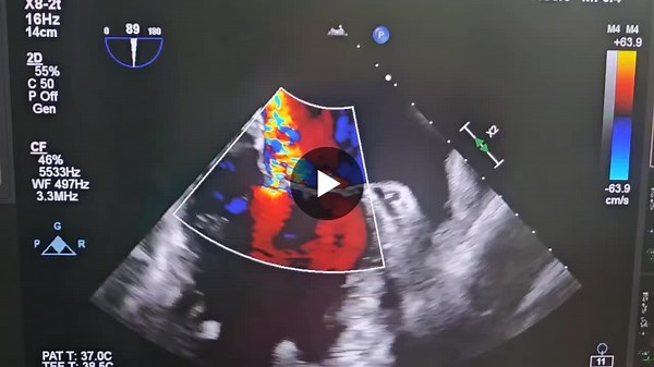 Philips SHD Solution Journey Success at Severance Hospital | GINA SEO posted on the topic | LinkedIn