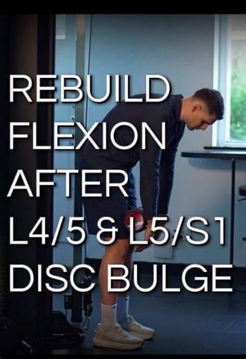 Overcoming Disc Bulge: Embrace Lumbar Flexion for Recovery