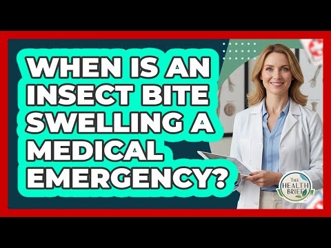 When Is An Insect Bite Swelling A Medical Emergency?