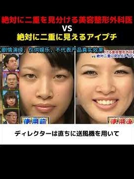 絶対に二重を見分ける美容整形外科医 VS 絶対に二重に見えるアイプチ #解説