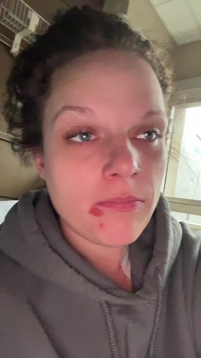 78K views · 3.8K reactions | Now I have this thing that is infected on my face. Like seriously?!? #givemeabreak #hospital #sundayfunday | Ashley McCombs Mizell | Facebook
