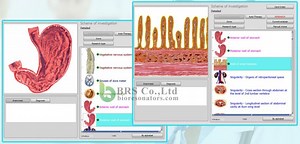 Digitalna bioresonančna naprava Bioplasm NLS za diagnozo in terapije