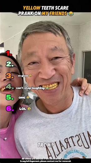 Yellow Teeth Scare Prank on My Friends 😂