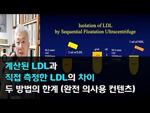 110.계산된 LDL과 직접 측정한 LDL의 차이와 두 방법의 한계 - 완전 의사용 컨텐츠