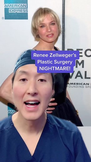 Renee Zellweger’s Plastic Surgery Nightmare! #reneezellweger #plasticsurgery #plasticsurgeon #botox #eyelidlift #browlift #beforeandafter