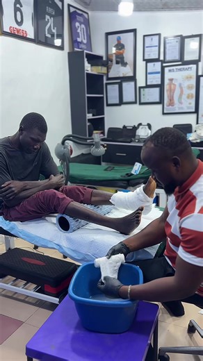 Understanding Bicortical Minimally Displaced Fibula Fractures