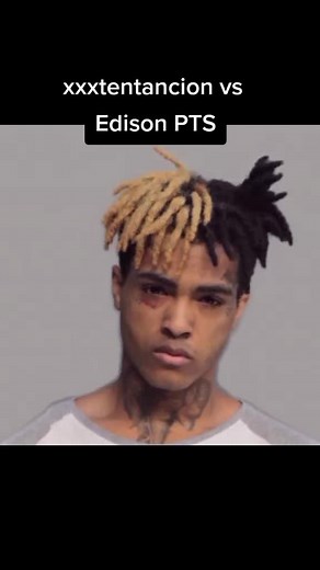 Tribute to XXXTentacion: A Visual Journey