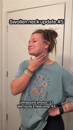 Swollen Neck Update: Ultrasound Results & New Lump Found