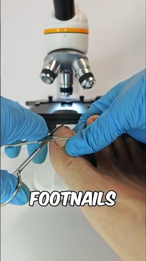 Foot nails under the microscope 🔬😱