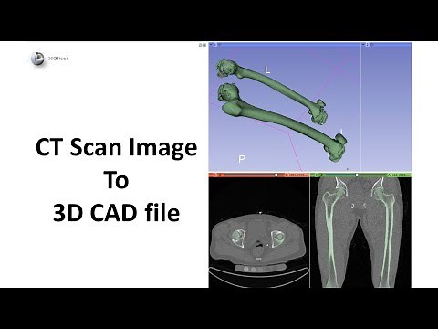 How to convert CT scan to 3D CAD Model