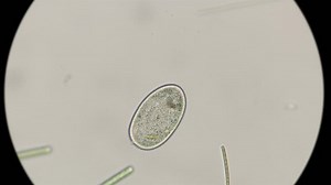 clip-1017389494-ciliated-protozoan-genus-paramecium-under-microscope