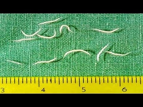 AWESOME TIPS : Pinworm Treatment In Adults - Cure Pinworm,