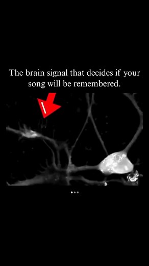 The craziest part about music? Your brain makes up its mind in seconds. The moment you hear a melody, your brain fires a signal: basically saying “save this” or “delete this.” And here’s the kicker: It comes down to the way rhythm, pitch, and repetition trigger dopamine. If you hit it, the brain locks it in memory. If you miss it, the song is forgotten before the hook even lands. Most writers never think about this hidden filter. (Or even know it exists) But hitmakers design their songs specific
