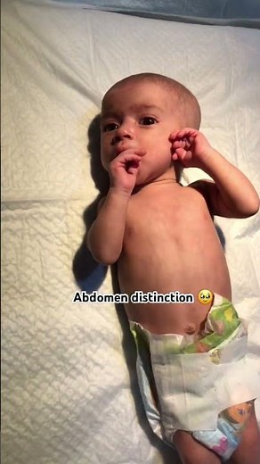 "#Neonatal Abdomen Distension: Causes and Management in NICU"🥀🫀🩺
