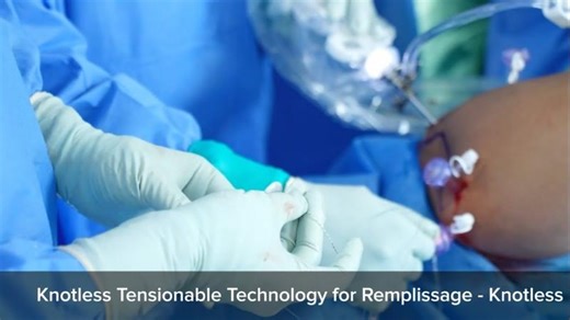 Bankart Repair with Knotless Tensionable Technology – Dr Deepak Chaudhary | Avana Medical Devices Pvt Ltd