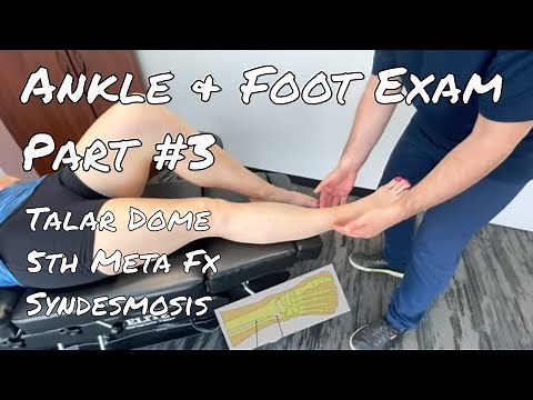 Ankle & Foot Exam Part #3 - Talar Dome, 5th Metatarsal Fx, Syndesmosis Damage