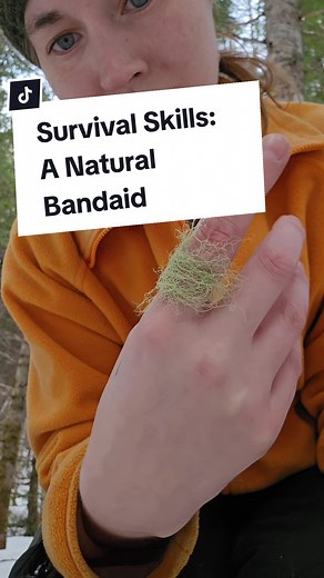 How to make a natural bandaid! #preppers #survival #survivalist #bushcraft #fyp #foryou #preparedness #beprepared #shtf #survival #prepping #prepper #nature