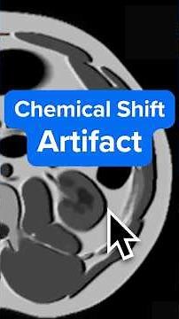 MRI Chemical Shift Artifact in 71 seconds – Why It Happens and How to Fix It